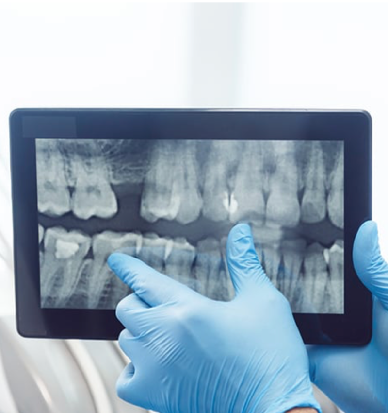 Regular Dental Checkup in Abu Dhabi