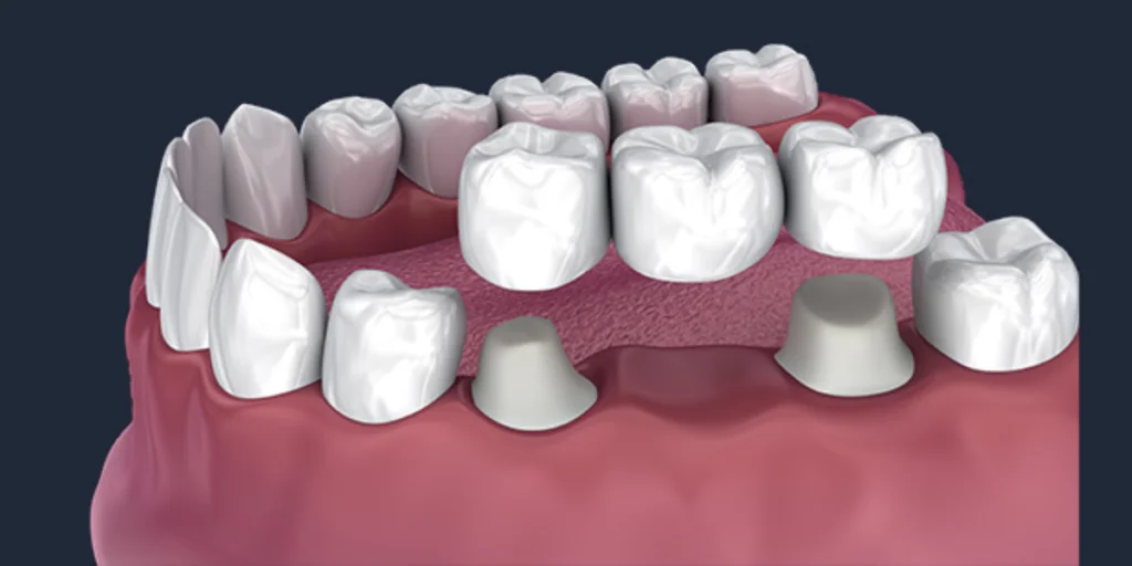 How-does-the-Procedure-Work