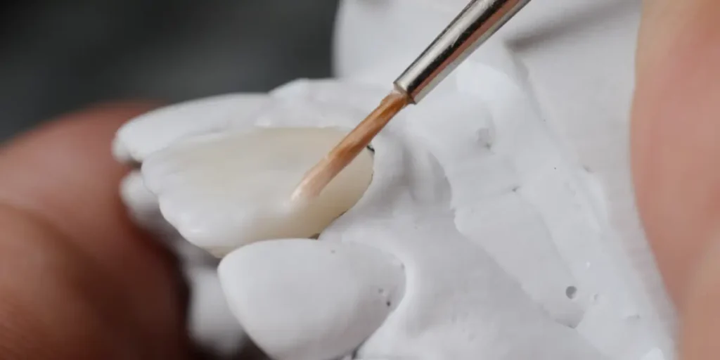 The-Procedure-What-to-Expect