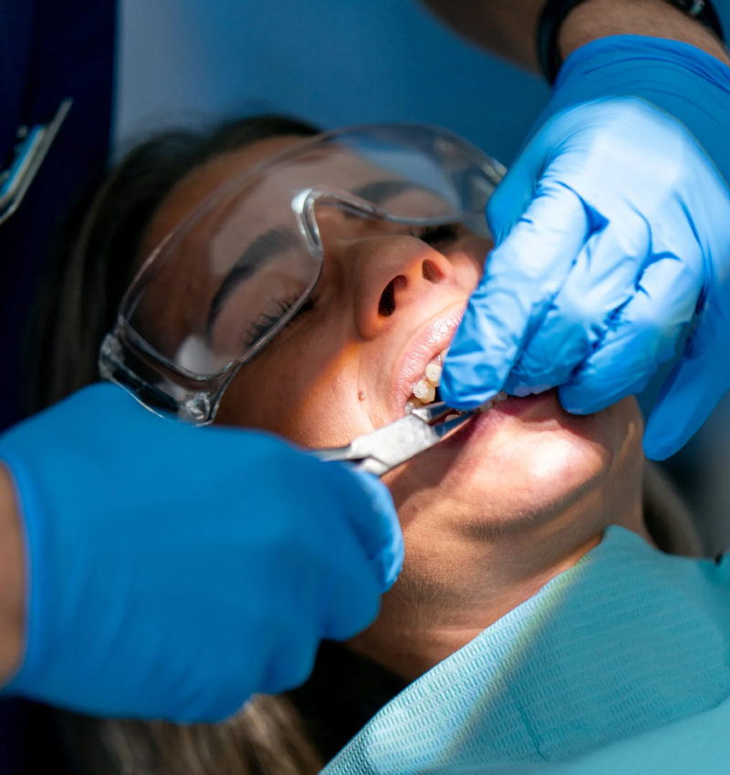 Wisdom Tooth Removal in Abu Dhabi