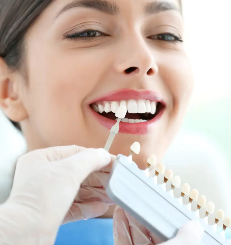 Best Emax & Composite Veneers in Abu Dhabi