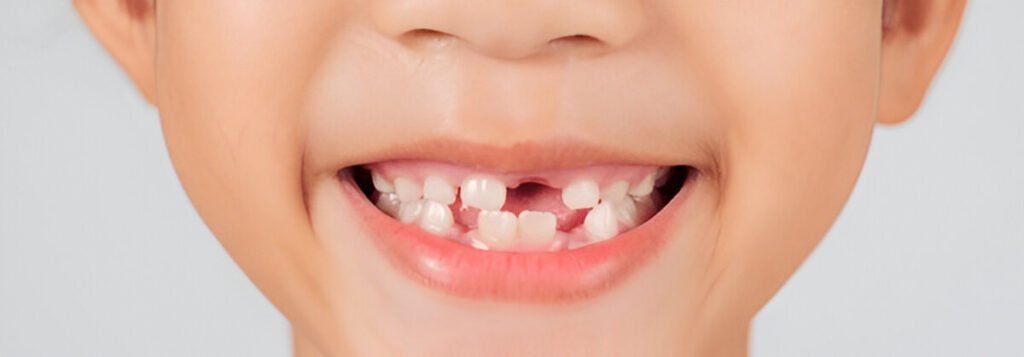 Why Do Baby Teeth Matter