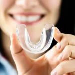 Dental night guards guide for teeth grinding and TMJ relief