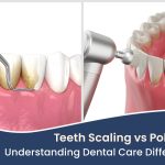 Teeth Scaling vs Polishing Understanding Dental Care Differences