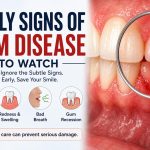 early sign of gum diseases