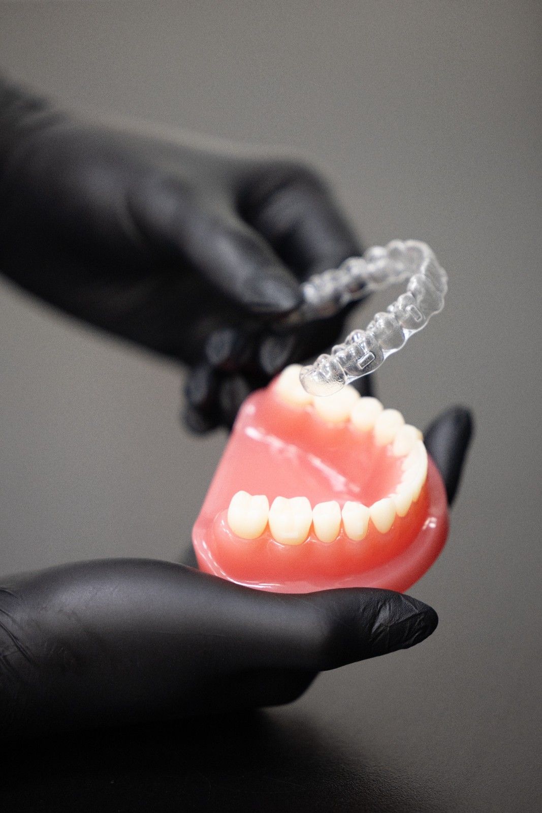 invisalign treatment