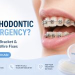 orthodontic emergency