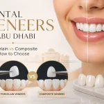 Dental Veneers in Abu Dhabi Porcelain vs Composite and How to Choose