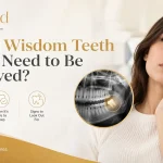 Do All Wisdom Teeth Really Need to Be Removed