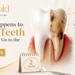 What Happens to Your Teeth If You Don't Go to the Dentist for Two Years