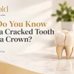 How Do You Know When a Cracked Tooth Needs a Crown