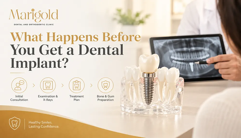 What Happens Before You Get a Dental Implant