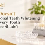 Why Doesn’t Professional Teeth Whitening Make Every Tooth the Same Shade