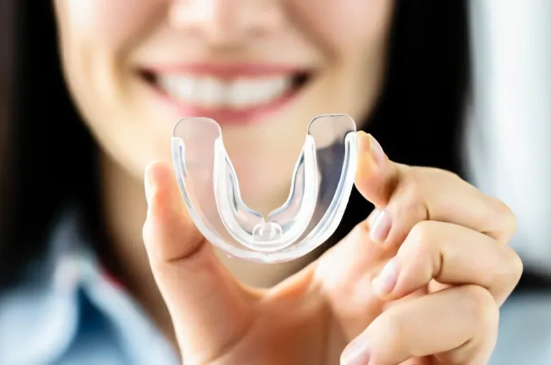 Dental night guards guide for teeth grinding and TMJ relief