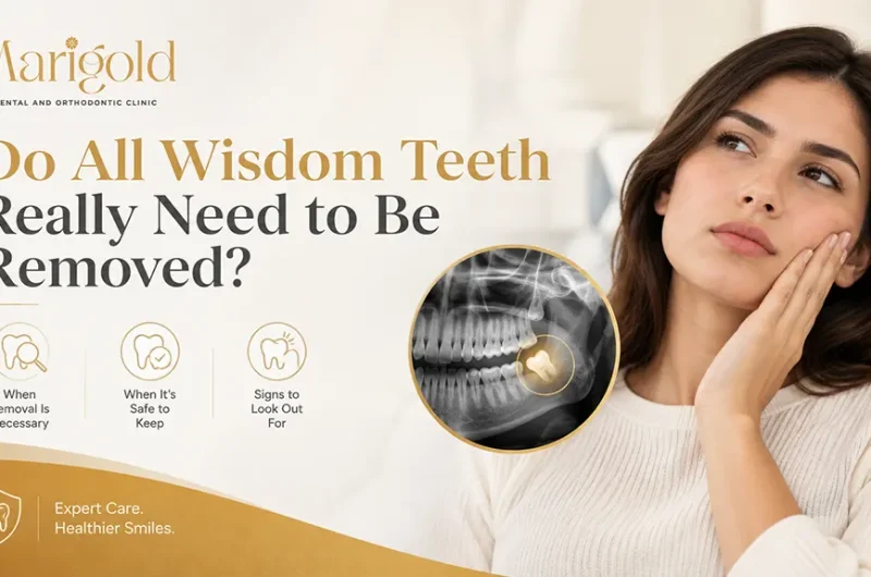 Do All Wisdom Teeth Really Need to Be Removed