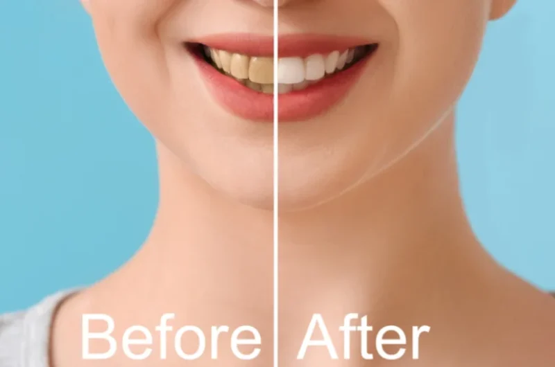 Does-Teeth-Scaling-And-Polishing-Make-Teeth-Whiter