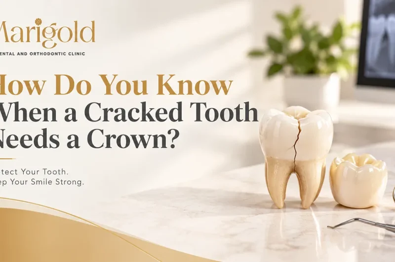 How Do You Know When a Cracked Tooth Needs a Crown