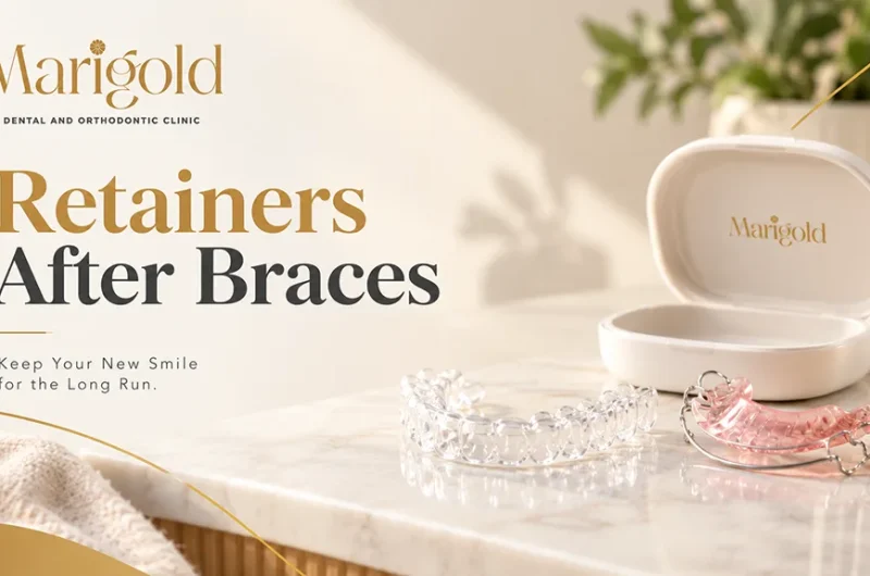 Retainers After Braces