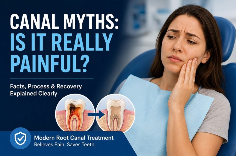 Root-canal-myths