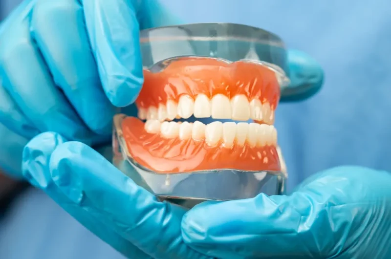 What Are Dentures Types, Care & Benefits