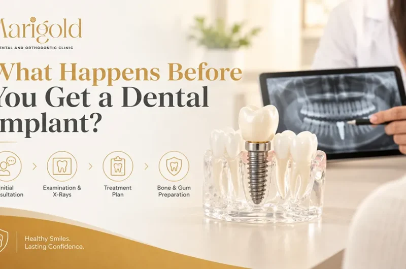 What Happens Before You Get a Dental Implant