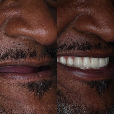 Best Dental Clinic in Abu Dhabi