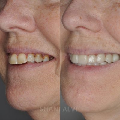 Best Dentists in Abu Dhabi