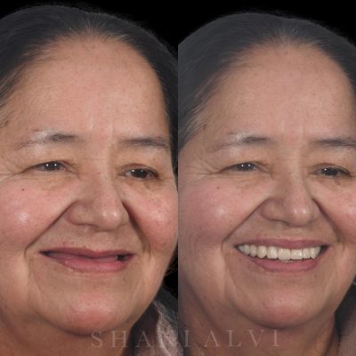 Best Dental Clinic in Abu Dhabi