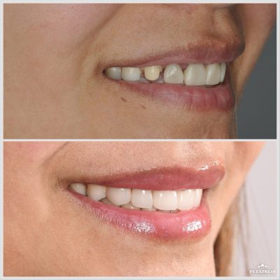 Perfect Smile Dental Centre