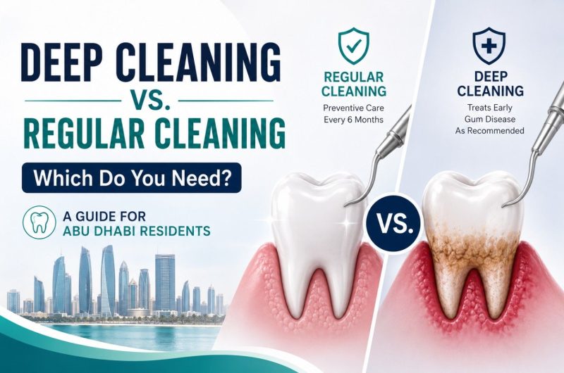 deep cleaning vs regular cleaning