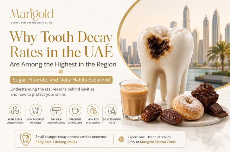 why tooth decay rates in the UAE